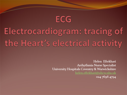 Presentation - ECG
