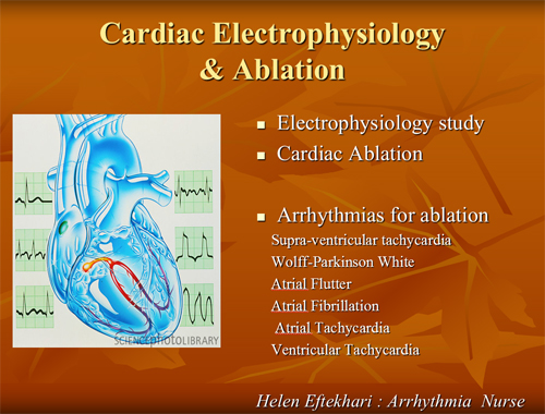 Presention - Cardiac Electrophyiology & Ablation