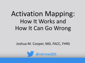 Activation Mapping: Basic Concepts, Pitfalls, and Windowing