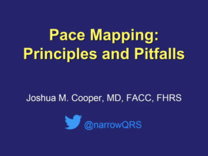 Pace Mapping: Principles and Pitfalls