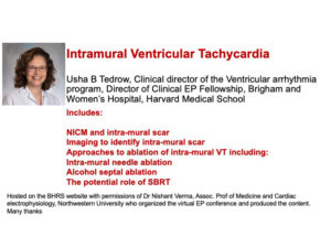 Intramural Ventricular Tachycardia