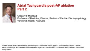 Atrial Tachycardia post-AF ablation: Part 2