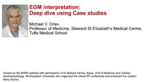 EGM interpretation: Deep dive using Case studies