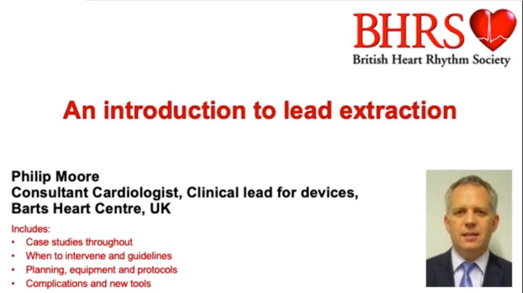 Lead Extraction Intro