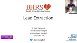 Lead Extraction
