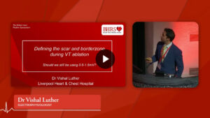 SESSION 4c: Defining the scar and borderzone during VT ablation - Dr Vishal Luther