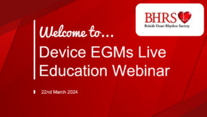 BHRS Webinar Recording: Device EGM's – 22nd March 2024